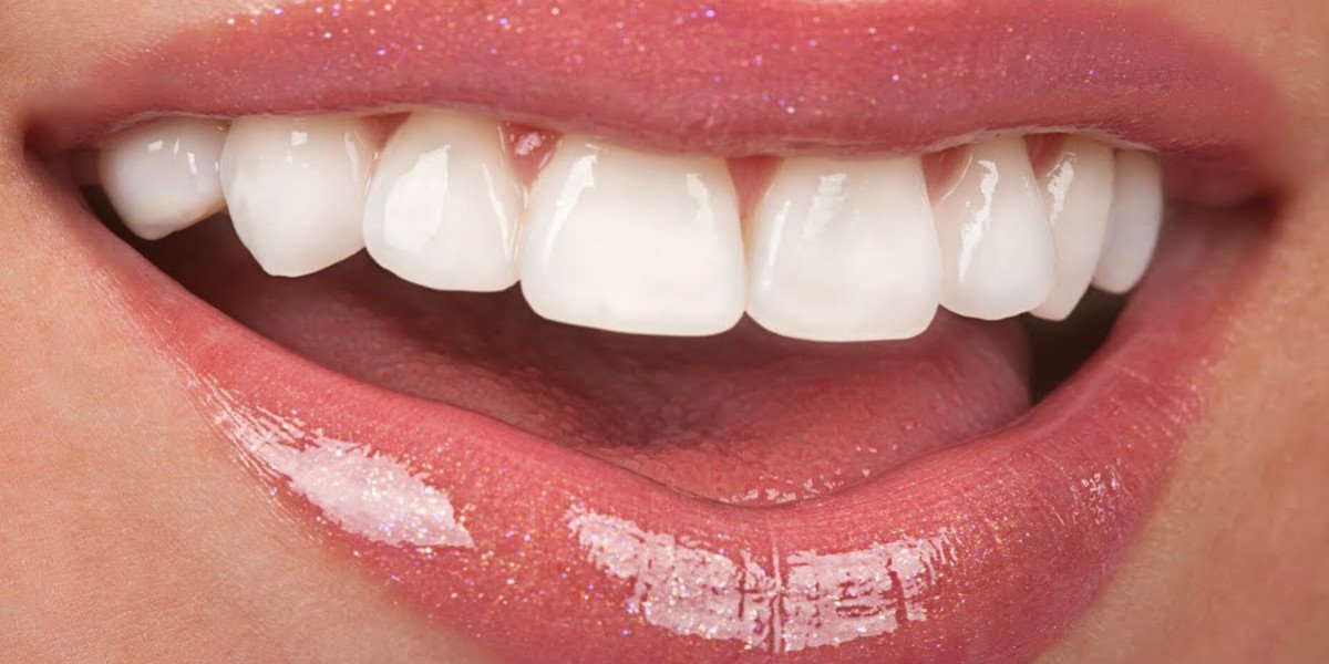 Veneer Dentistry Cost Guide: Prices & Factors in 2025
